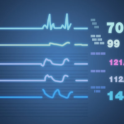 Patient Monitor Showing Vital Signs Ecg And Ekg. Vector Illustra Patient Monitor Showing Vital Signs Ecg And Ekg. Vector Illustra